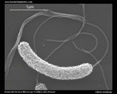 vibrio cholerae microscopic appearance